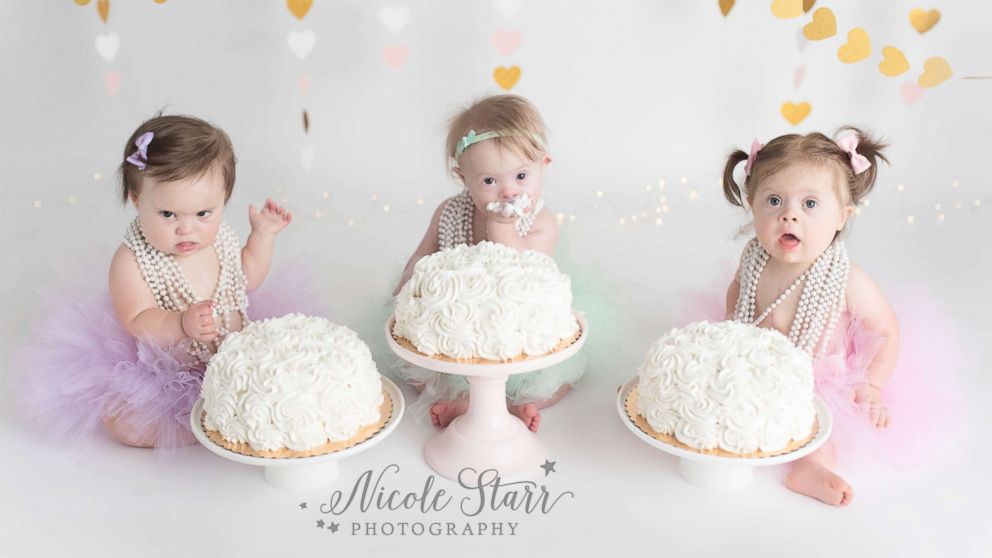 3 baby girls born in 3 days with 3 heart surgeries celebrate birthday