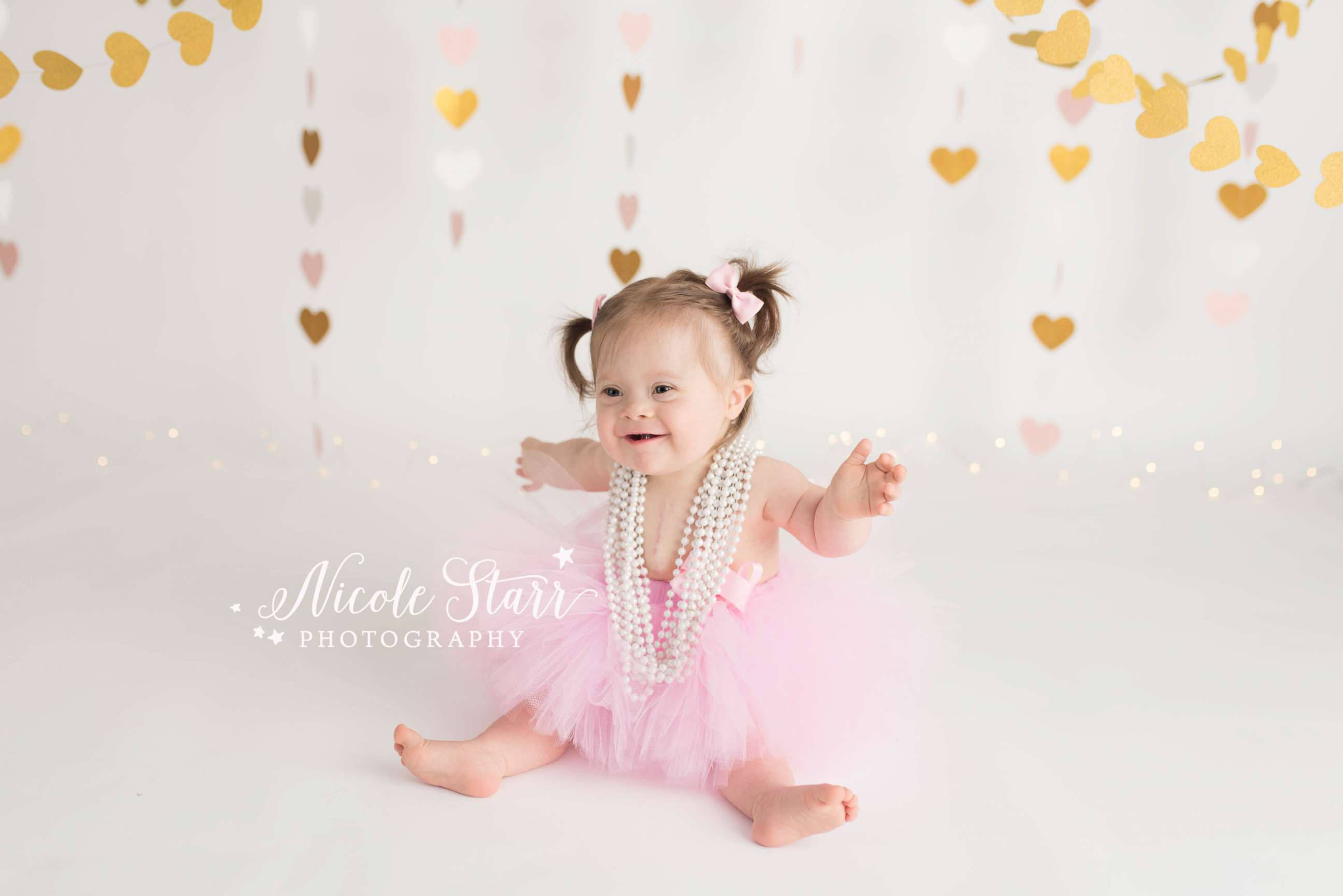 PHOTO: Babies' Three of Hearts photo shoot celebrates Down syndrome and life after heart surgery.