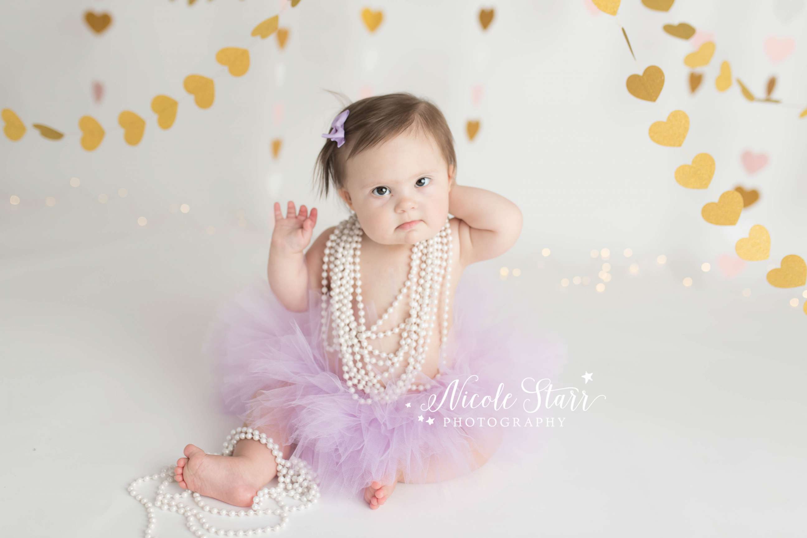 PHOTO: Babies' Three of Hearts photo shoot celebrates Down syndrome and life after heart surgery.

