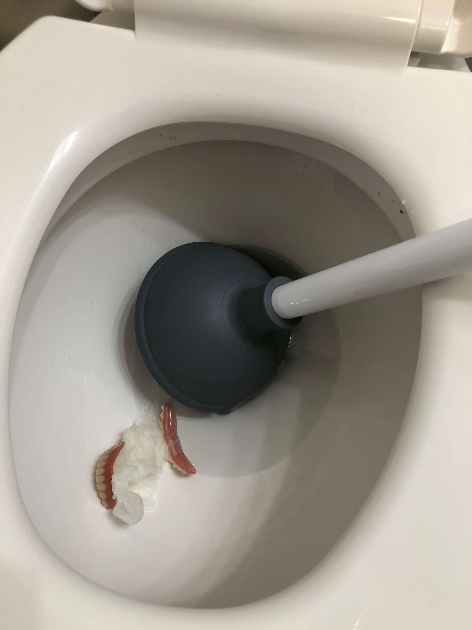 PHOTO: A California plumber was surprised when these dentures showed up in a clogged toilet.