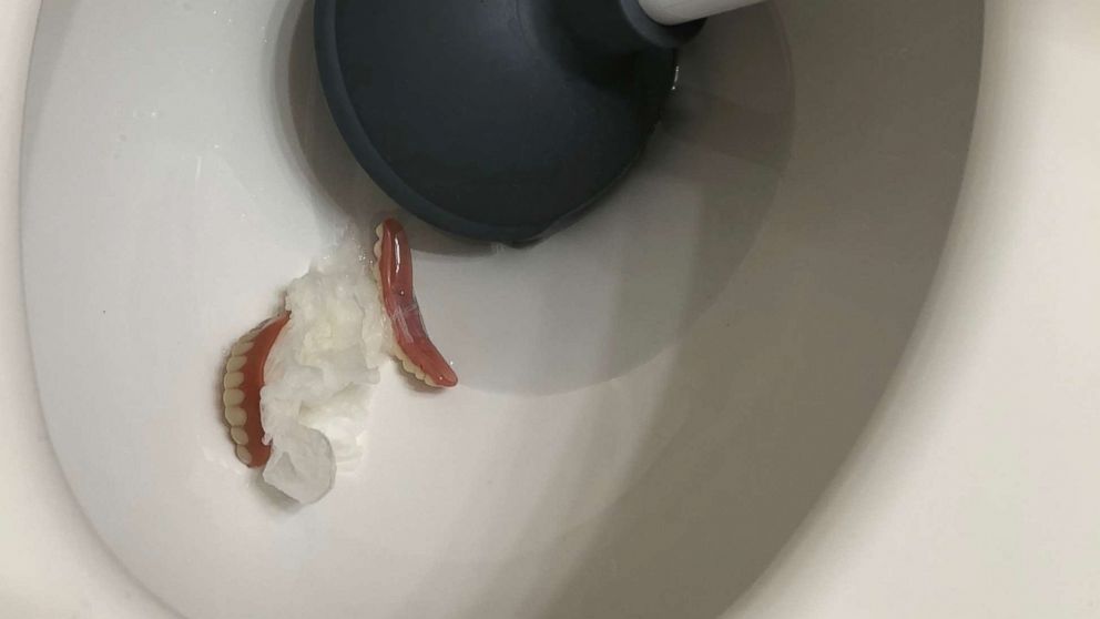 PHOTO: A California plumber was surprised when these dentures showed up in a clogged toilet.