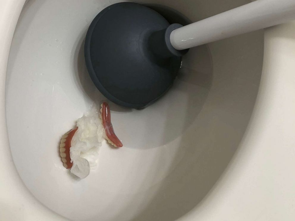 PHOTO: A California plumber was surprised when these dentures showed up in a clogged toilet.