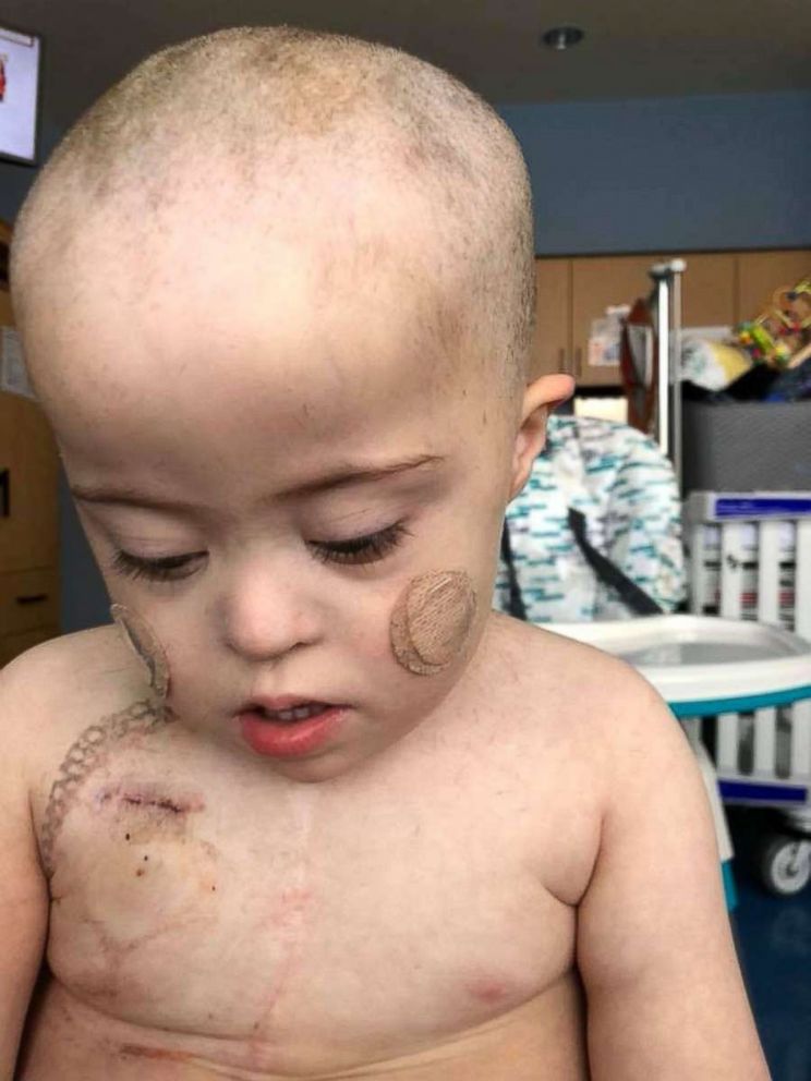 PHOTO: Nichole Brooks made the decision to cut her son Wyatt's hair before cancer took it. 