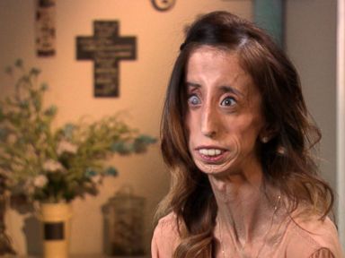 Lizzie Velasquez on Turning a Life of Bullying into Powerful Motivation