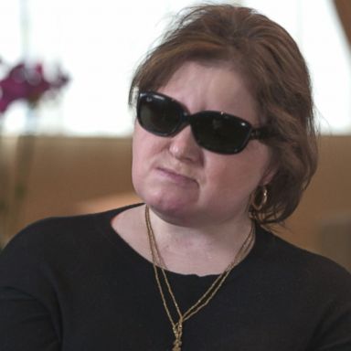 VIDEO: US's youngest face transplant recipient shares story of suicide survival, hope