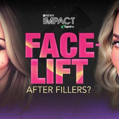 IMPACT x Nightline: Facelift: After Fillers? Trailer