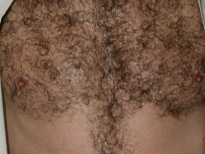 Chest Hair