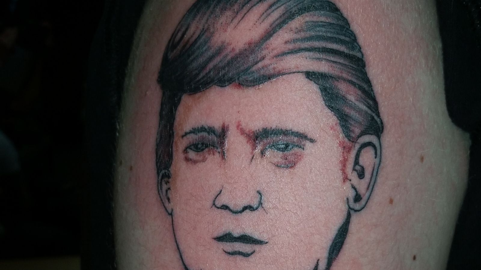 Saving face: Indiana man removing Romney-Ryan tattoo