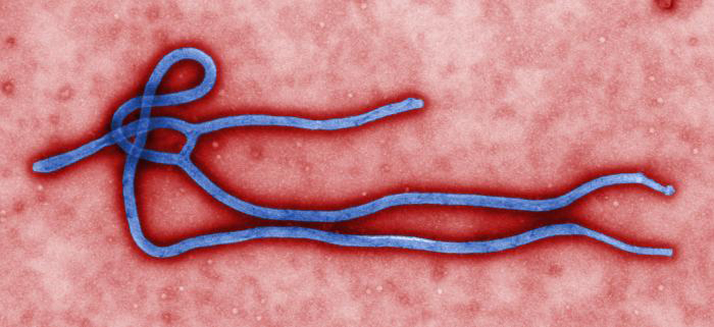PHOTO: An Ebola virus is shown in this undated file image by the CDC.