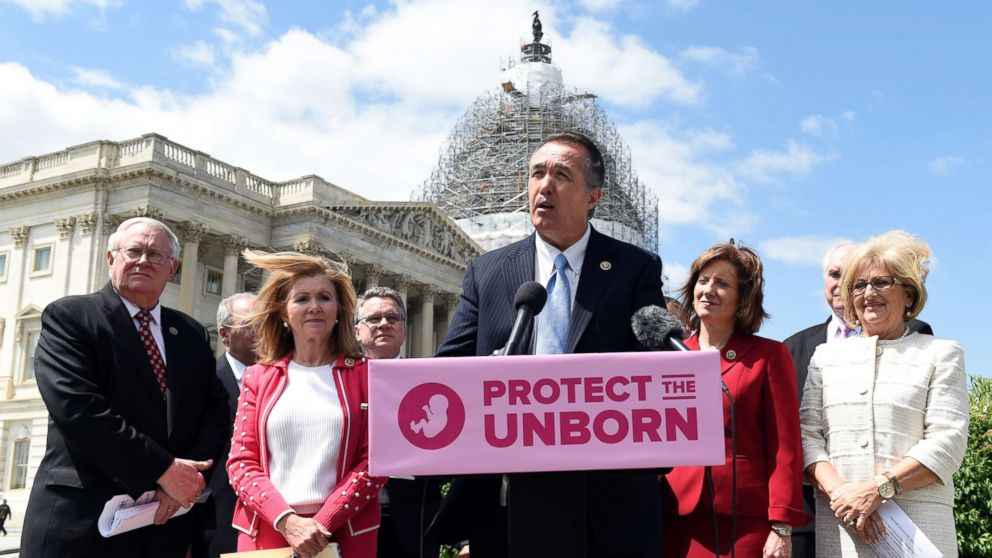 PHOTO: Rep. Trent Franks, R-Ariz., center, speaks during a news conference on the Pain-Capable Unborn Child Protection Act  on Capitol Hill in Washington, Wednesday, May 13, 2015. 