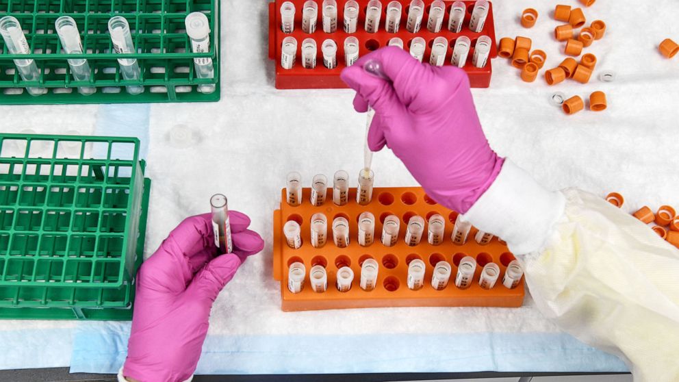 PHOTO: A lab technician sorts blood samples for COVID-19 vaccination study at the Research Centers of America in Hollywood, Fla. Aug. 13, 2020.