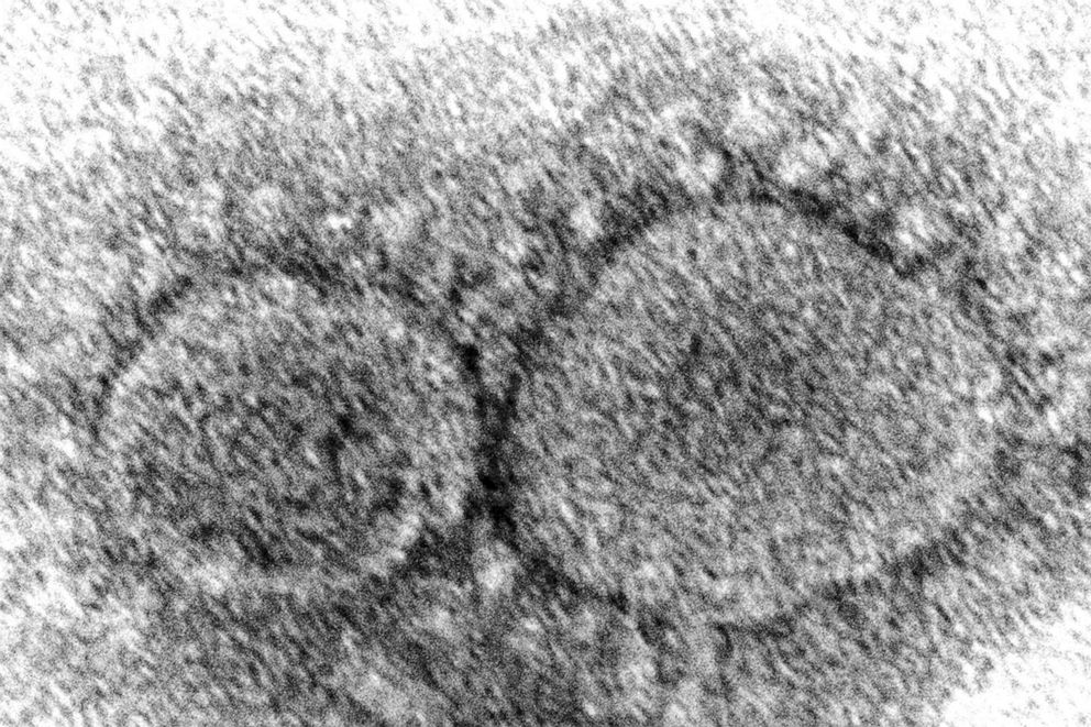 PHOTO: This 2020 electron microscope image made available by the Centers for Disease Control and Prevention shows SARS-CoV-2 virus particles, which cause COVID-19.