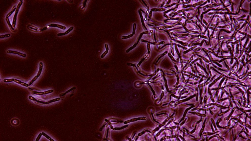 Pentagon Inadvertently Shipped Live Anthrax to Labs in Nine States ...