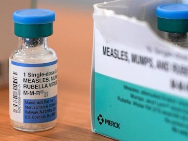 Measles cases linked to Texas outbreak hit 309, surpassing nationwide total in 2024