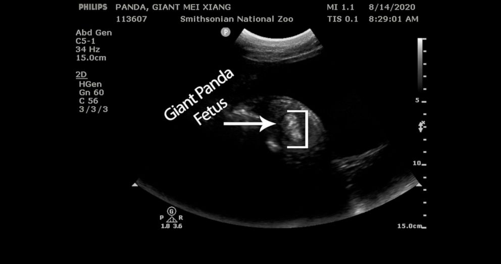 PHOTO: Veterinarians at the Smithsonian's National Zoo detected tissue consistent with fetal development during giant panda Mei Xiang's ultrasound, Aug. 14, 2020.