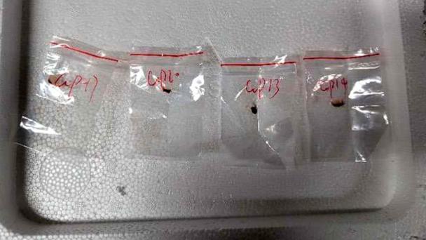 This photo released by the U.S. District Court for the Eastern District of Michigan shows what authorities say are biological pathogens discovered in luggage at the airport in Detroit.