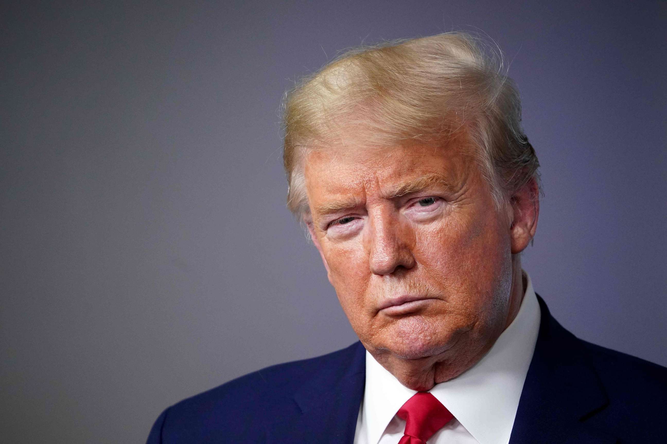 PHOTO: President Donald Trump looks on during the daily briefing on the novel coronavirus, COVID-19, in the Brady Briefing Room at the White House, March 31, 2020, in Washington.