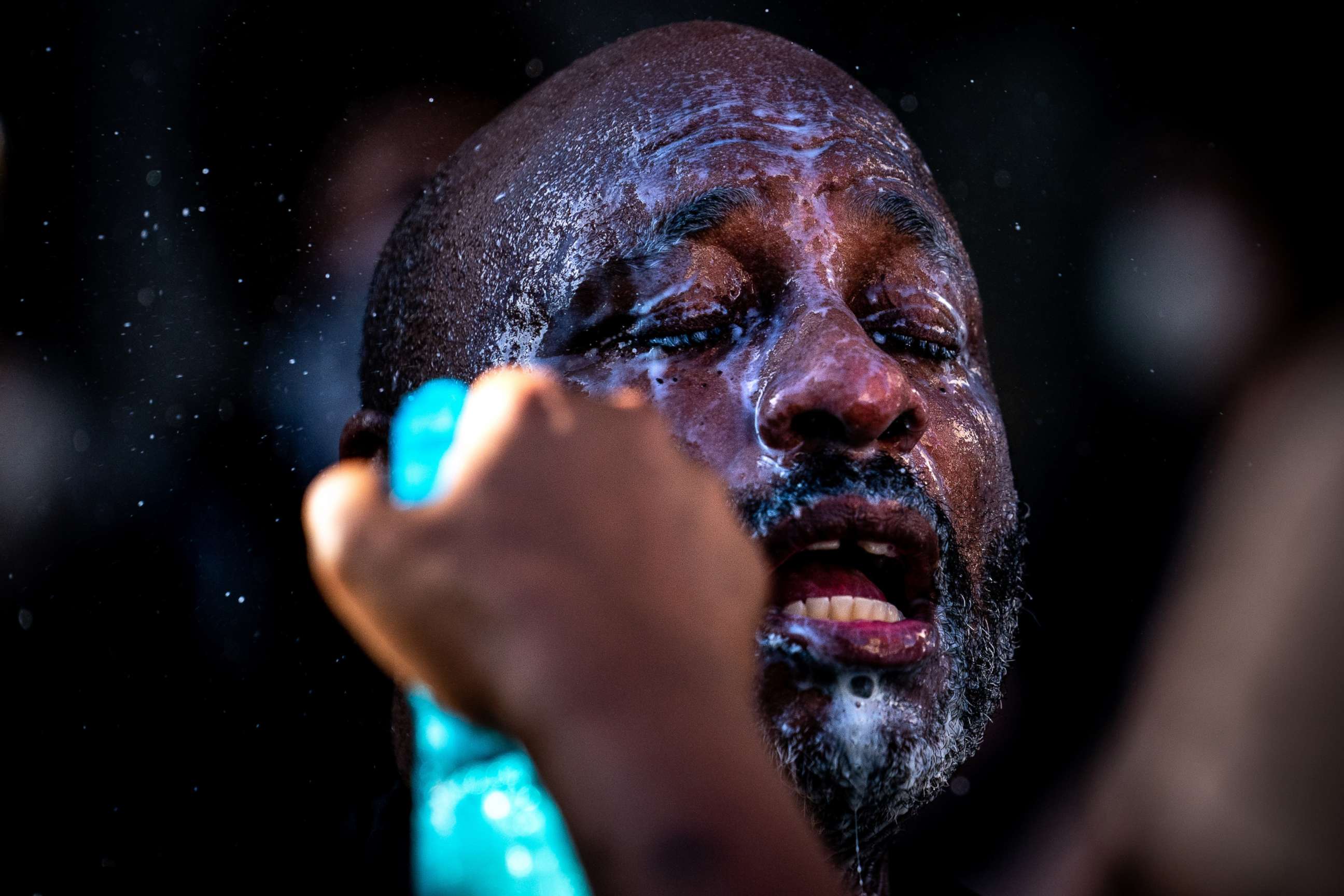 PHOTO: A protester's face is washed off after police dispersed demonstrators near the White House in Washington, June 1, 2020.