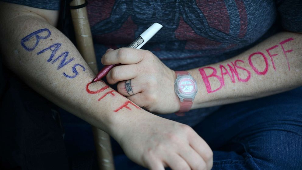 PHOTO: An activist writes the words 'Bans Off' on their arms while gathering for a rally in Washington, May 14, 2022.