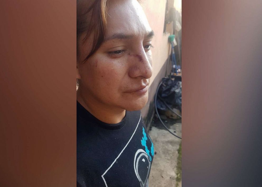 PHOTO: Estrella Santos Zacarias, a Guatemala native and transgender woman, is seeking asylum in the U.S. Her case will be heard at the Supreme Court on Jan. 17, 2023.