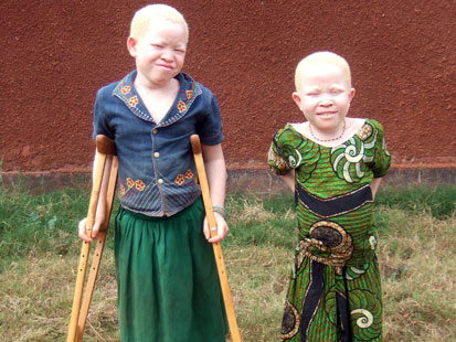 Image result for albino killed in tz
