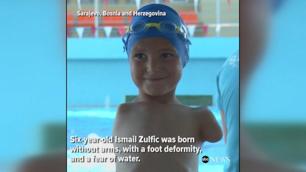 Video Boy Born Without Arms Wins Gold Medal In Swimming Abc News 2813