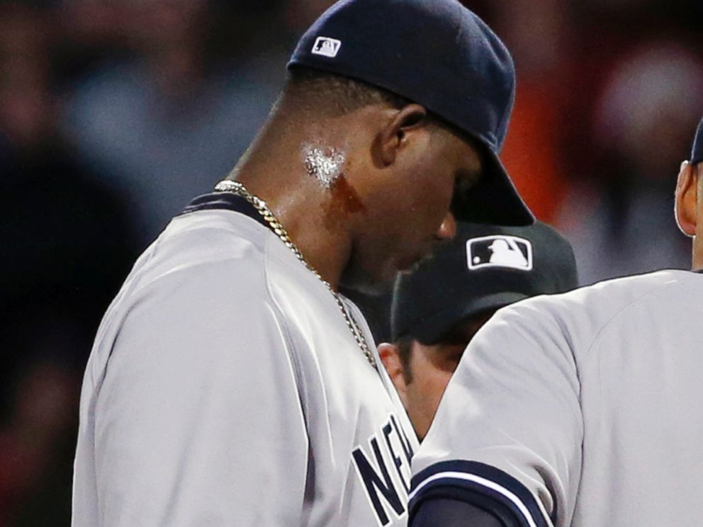 PHOTO: A substance can be seen on Yankees pitcher Michael Pineda's neck, April 23, 2014.