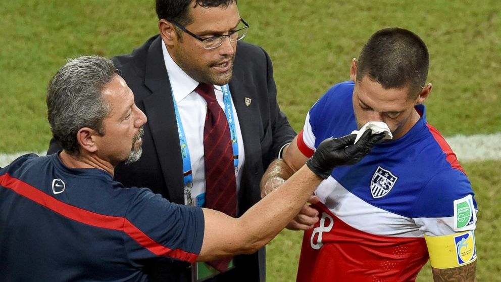 Clint Dempsey just got his face broken 