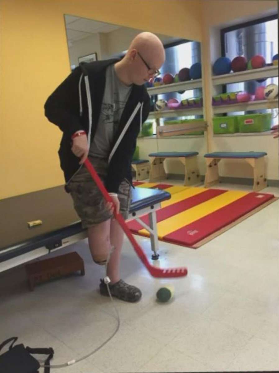 PHOTO: Bretton Chitwood still dreamed of playing hockey, despite losing his foot to cancer.