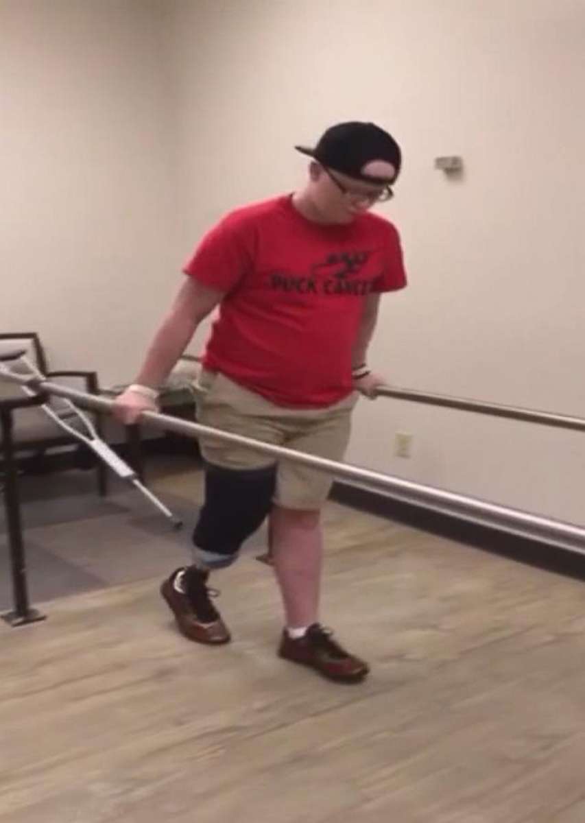 PHOTO: Bretton Chitwood learns how to walk again after his foot amputation.