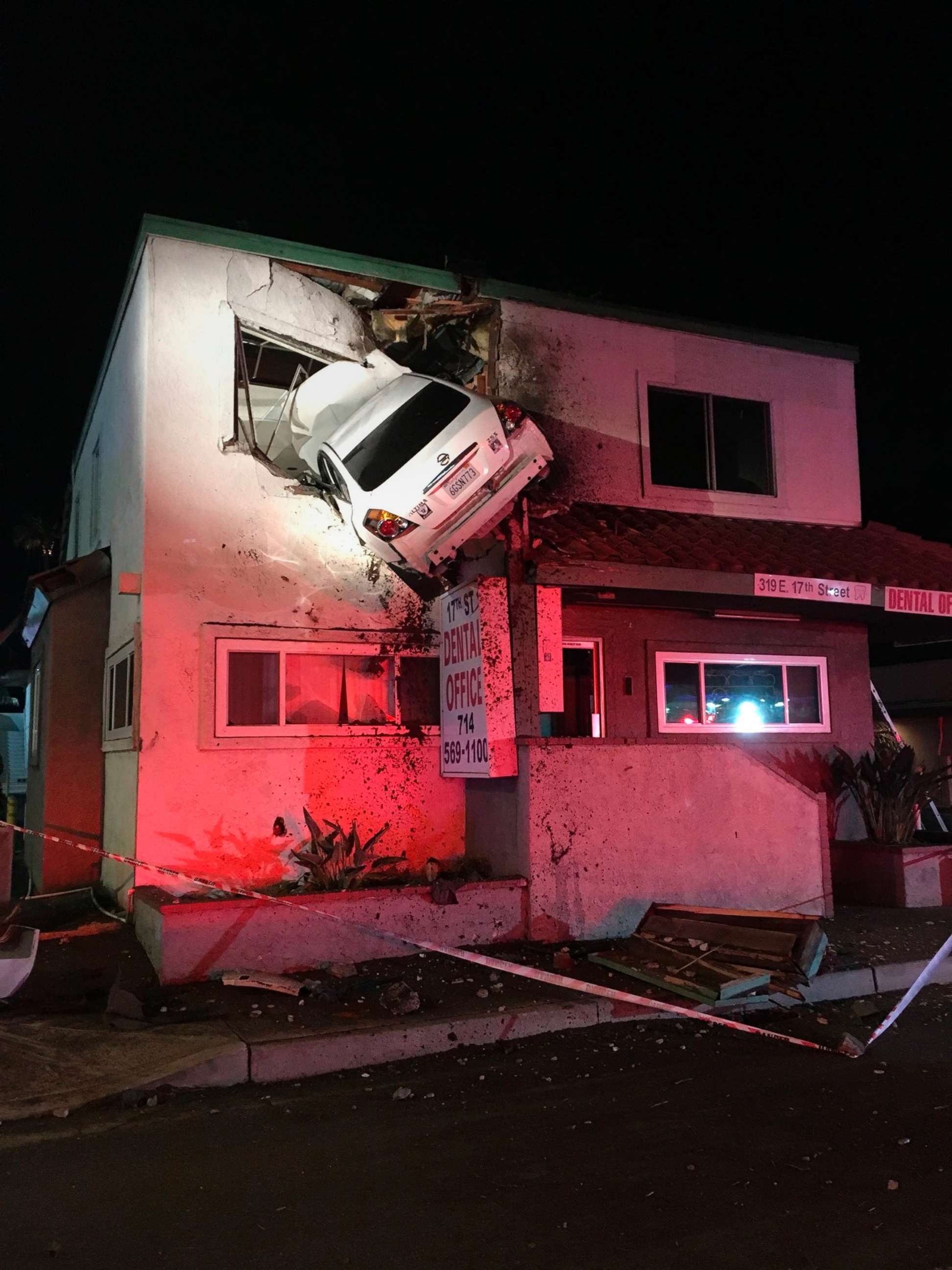 PHOTO: A vehicle that crashed into a building hangs from a second story window in Santa Ana, Calif., Kam/ 14. 2018. Two people escaped serious injuries when the car hit a divider, went airborne and slammed into the second floor of a dental office.