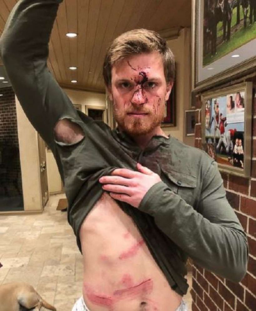 PHOTO: Conner Capel, 21, a member of the St. Louis Cardinals organization, filed suit against a Houston bar over allegedly being beaten up by a bouncer on Jan. 1, 2019.