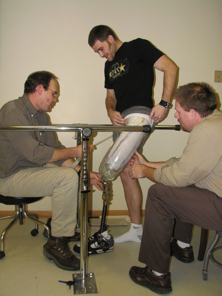 PHOTO: In 2008, while participating in a snowmobiling race, Mike Schultz was badly injured. He had his leg amputated. He said BioDapt came about after he sought to create a prosthetic limb that allowed him to ride dirt bikes and snowmobiles again. 