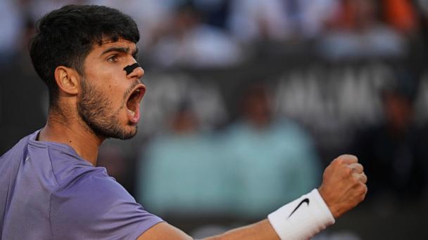 FILE - Spain's Carlos Alcaraz, wearing a nasal strip, reacts after scoring a point against Italy's Jannik Sinner in the final of the Italian Open tennis tournament at the Foro Italico in Rome, May 18, 2025. (AP Photo/Alessandra Tarantino, File)