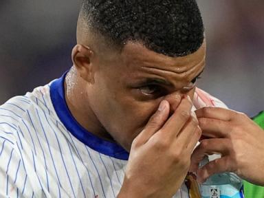 More changes to Mbappé face mask as France star's Euro 2024 problems persist