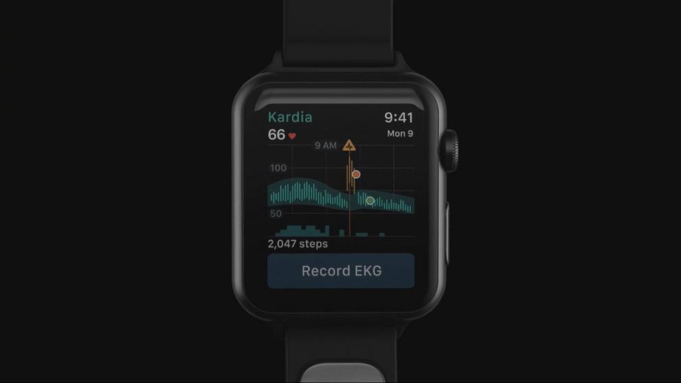 Ekg sensor best sale apple watch