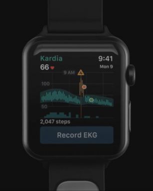 VIDEO: EKG band for Apple Watch can monitor your heart rhythm