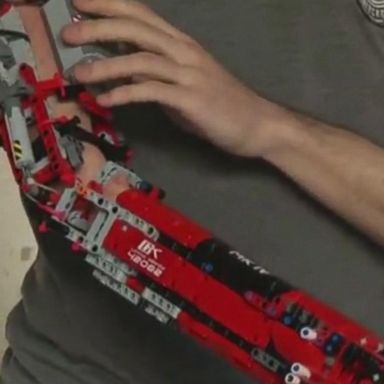 VIDEO: This 19-year-old student has built himself a robotic prosthetic arm using LEGO pieces after being born without a right forearm due to a rare genetic condition.