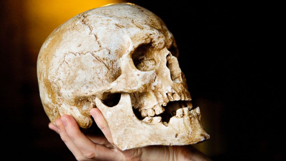 A human skull is seen in this undated file photo.