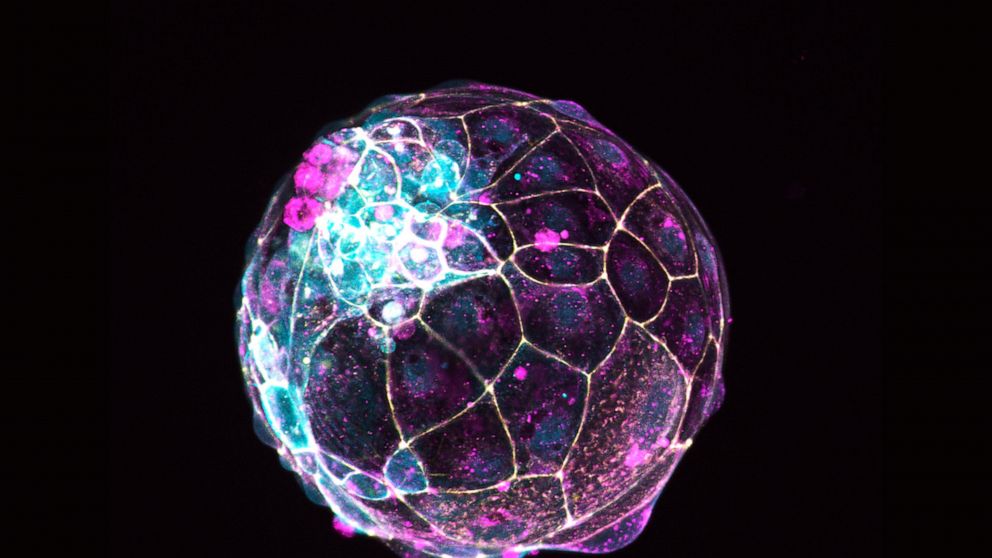 Scientists use stem cells to create models of pre-embryos