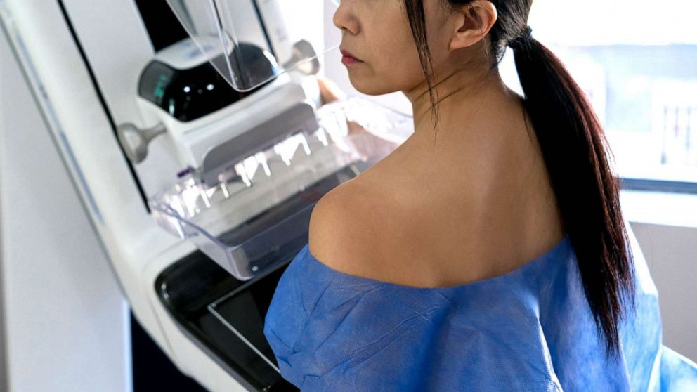 AI-powered computer 'outperformed' experts in spotting breast cancer