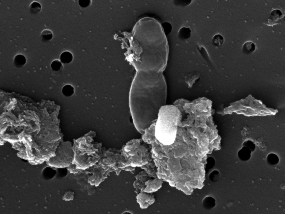 PHOTO: This scanning electron microscope image shows material taken from an ancient water deposit. Researchers believe the peanut-shaped object in the middle may be a cell dividing.