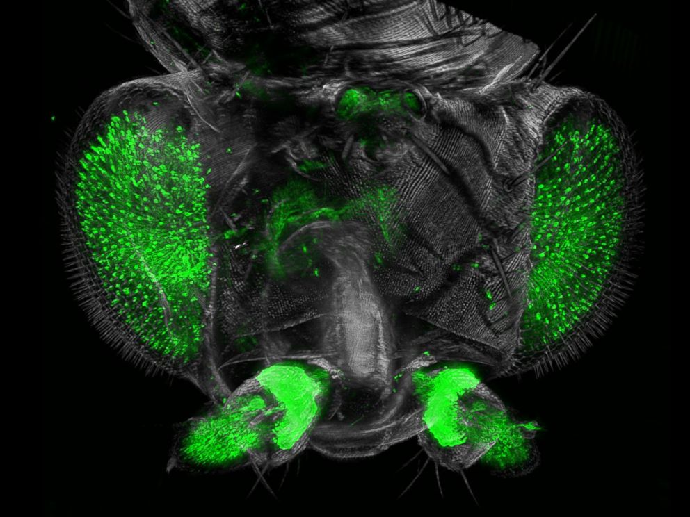 PHOTO: An ultramicroscope picture of the head of the fruit fly Drosophila melanogaster.
