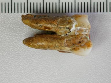 The Broken Bloodlines of Human Origin