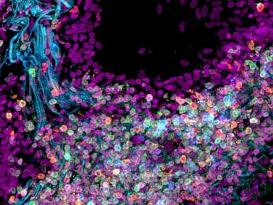 Scientists map out the human body one cell at a time