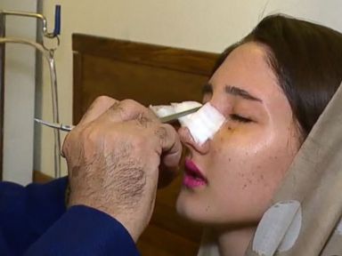 VIDEO: From Nose Jobs to Steve Jobs, Young Iranians Embrace Western Influence