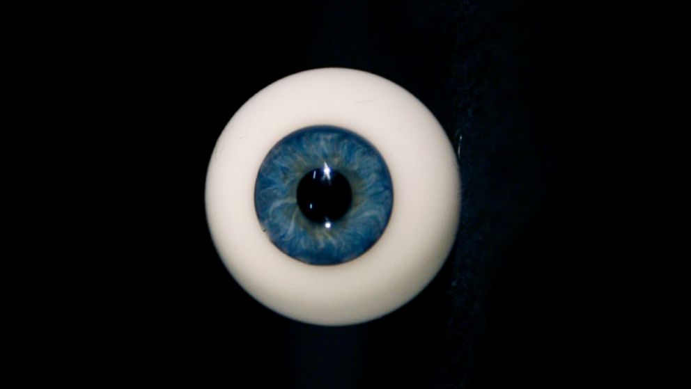 A glass eye is just one surprising item left behind on planes. 