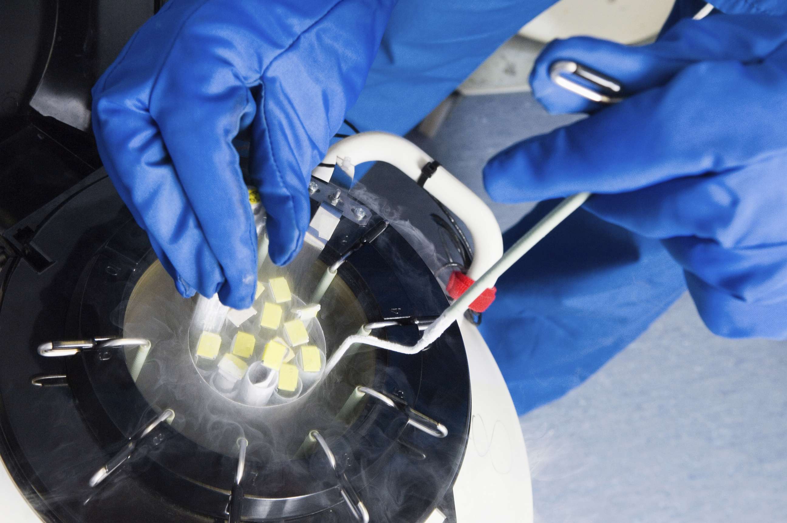 PHOTO: Doctors hands removing embryo samples from cryogenic storage, fertilized embryos are stored in liquid nitrogen filled tanks to keep them as new if patients require them at a later date.