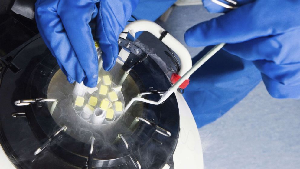 PHOTO: Doctors hands removing embryo samples from cryogenic storage, fertilized embryos are stored in liquid nitrogen filled tanks to keep them as new if patients require them at a later date.