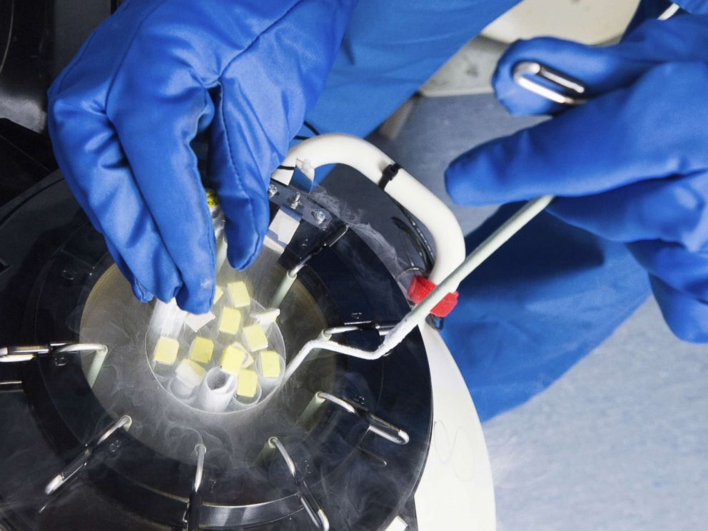 PHOTO: Doctors hands removing embryo samples from cryogenic storage, fertilized embryos are stored in liquid nitrogen filled tanks to keep them as new if patients require them at a later date.